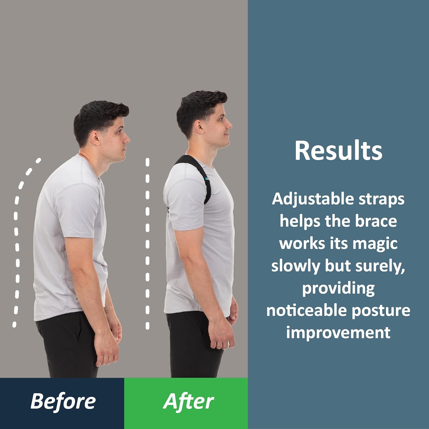ComfyBrace Posture Corrector-Back Brace for Men and Women- Fully Adjustable Straightener for Mid, Upper Spine Support- Neck, Shoulder, Clavicle and Back Pain Relief-Breathable - Image 3